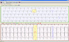 QRS Card Holter System CS2