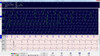 CardioScan 10 - Cardiac Holter System