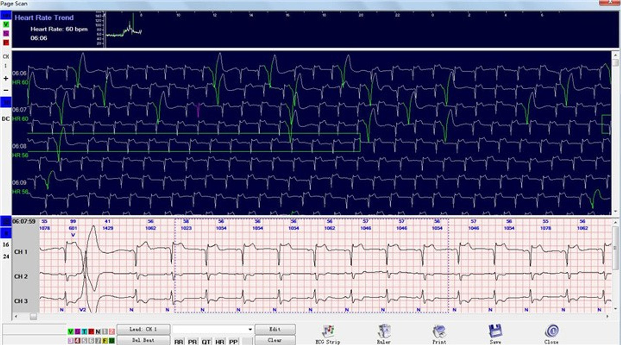 CardioScan 10 - Cardiac Holter System