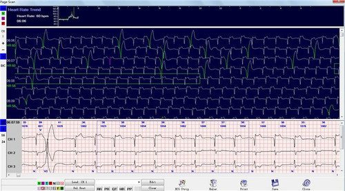 CardioScan12- Cardiac Holter System CardioScan12- Cardiac Holter System