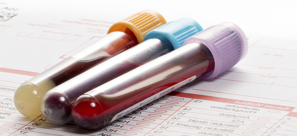 Análisis y control de colesterol en farmacia en Gandía