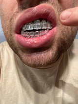 HarlemBling Real Solid 925 Sterling Silver Grillz Baguette Iced Grills Top Or Bottom Teeth