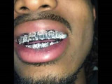 HarlemBling Real Solid Hip Hop 925 Sterling Silver Grillz Baguette Diamond Iced Grills Set