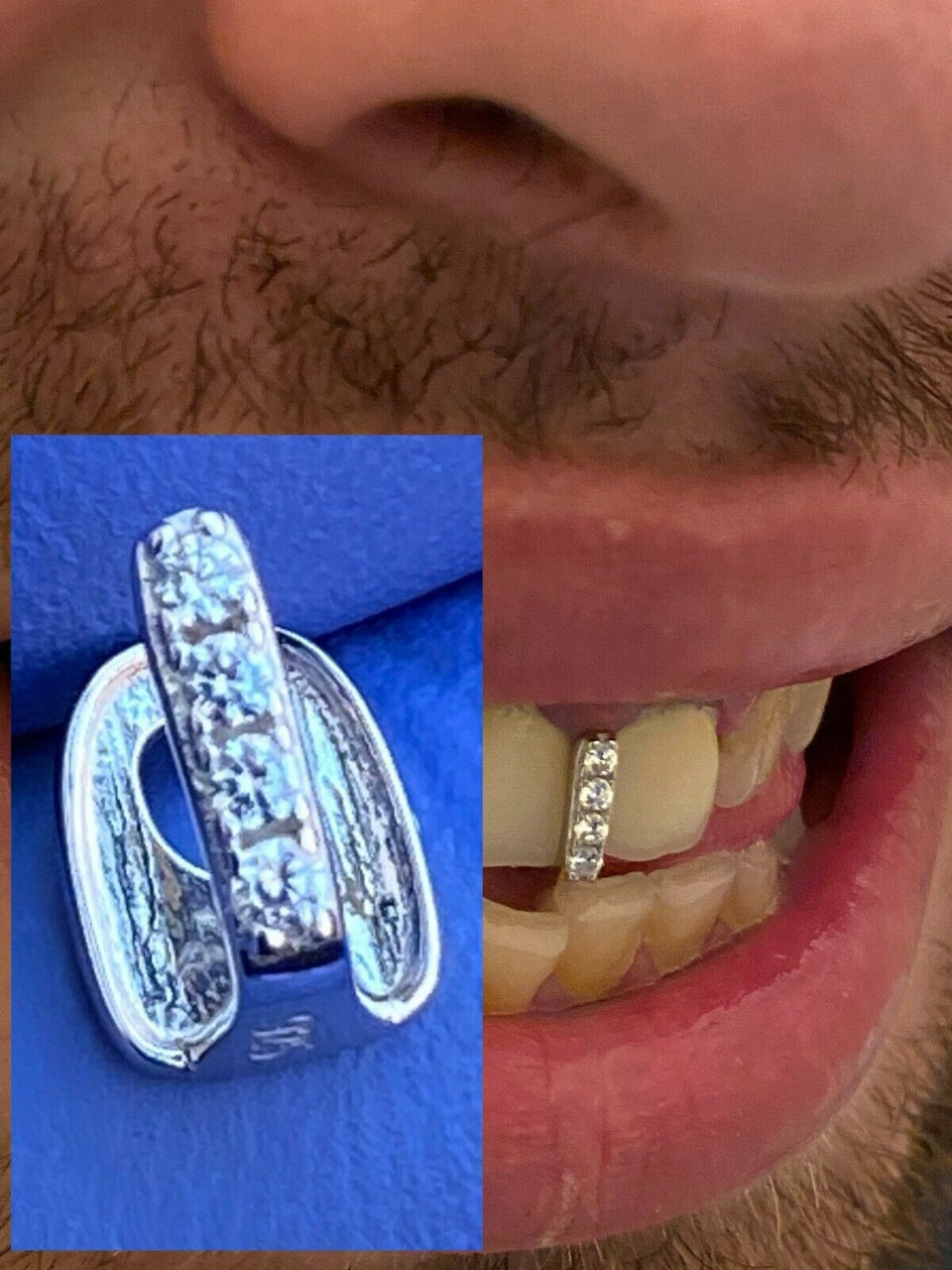 SOLID 925 Sterling Silver Gap Grillz Single Tooth Hip Hop Grill Cap