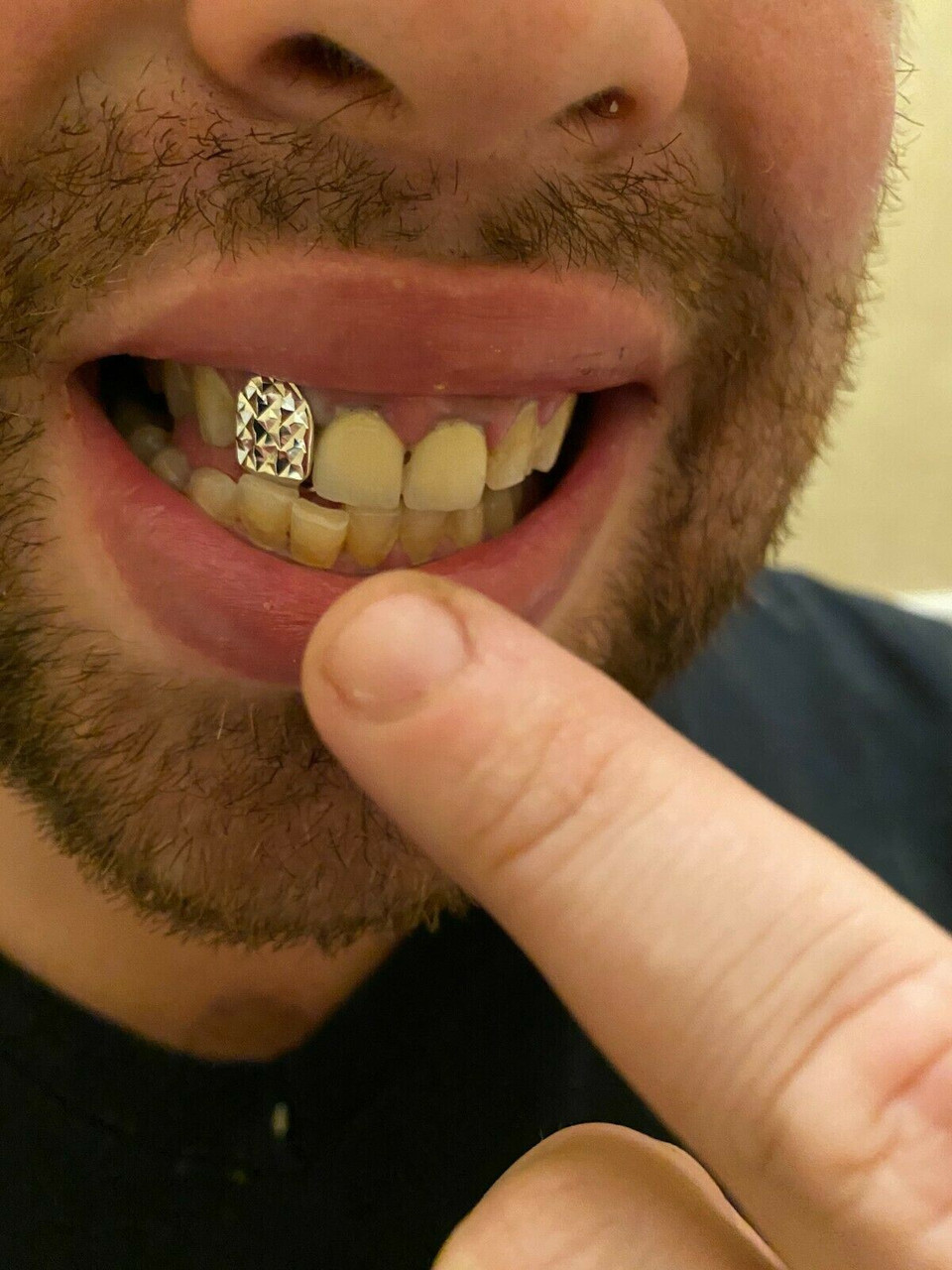 silver teeth grillz