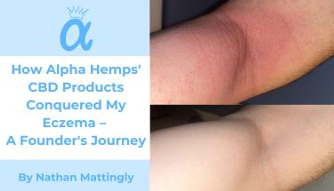 How Alpha Hemps' CBD Products Conquered My Eczema – A Founder's Journey