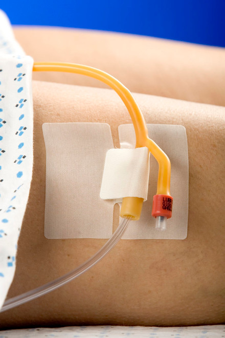 Cath Tube Holder With Hypoallergenic Tape 50Ea/Cs
