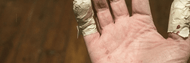 The 3 Most Common Types of Hand Injuries in the Workplace (and How to Prevent Them)