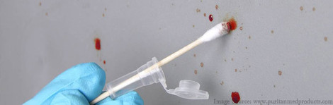 The Role of Swabs in Forensic Science