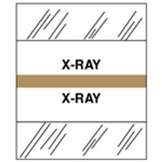 "X-Ray" Patient Chart Index Divider Tabs - 100/Package