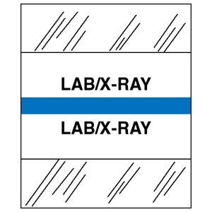 Tabbies 54531 - Patient Chart Index Tabs/Labels - "Lab/X-Ray" - Lt. Blue - 1/2" H x 1-1/4" W Tabs - 100/Package