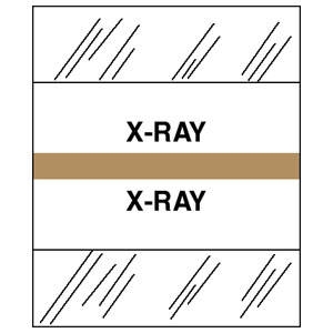 Tabbies 54542 - Patient Chart Index Tabs -  "X-Ray" - Tan - 1-1/4" Tabs - 100/Package