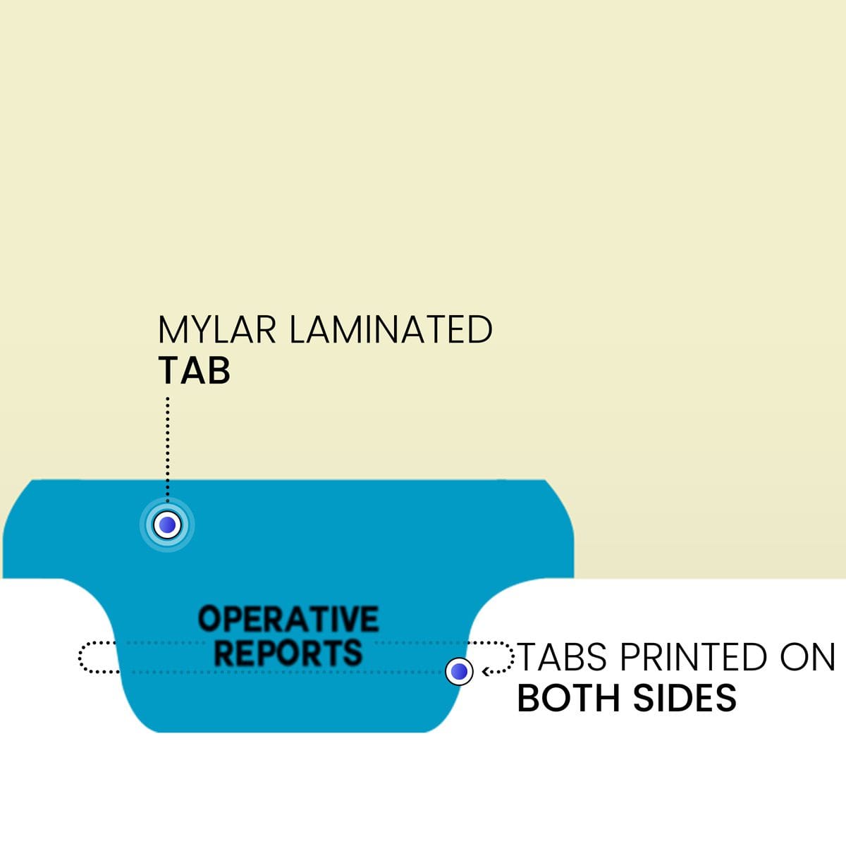"Operative Reports" - Index Chart Divider-  Bottom Tab in Position 3 - Blue Colored Tab - 100/Package