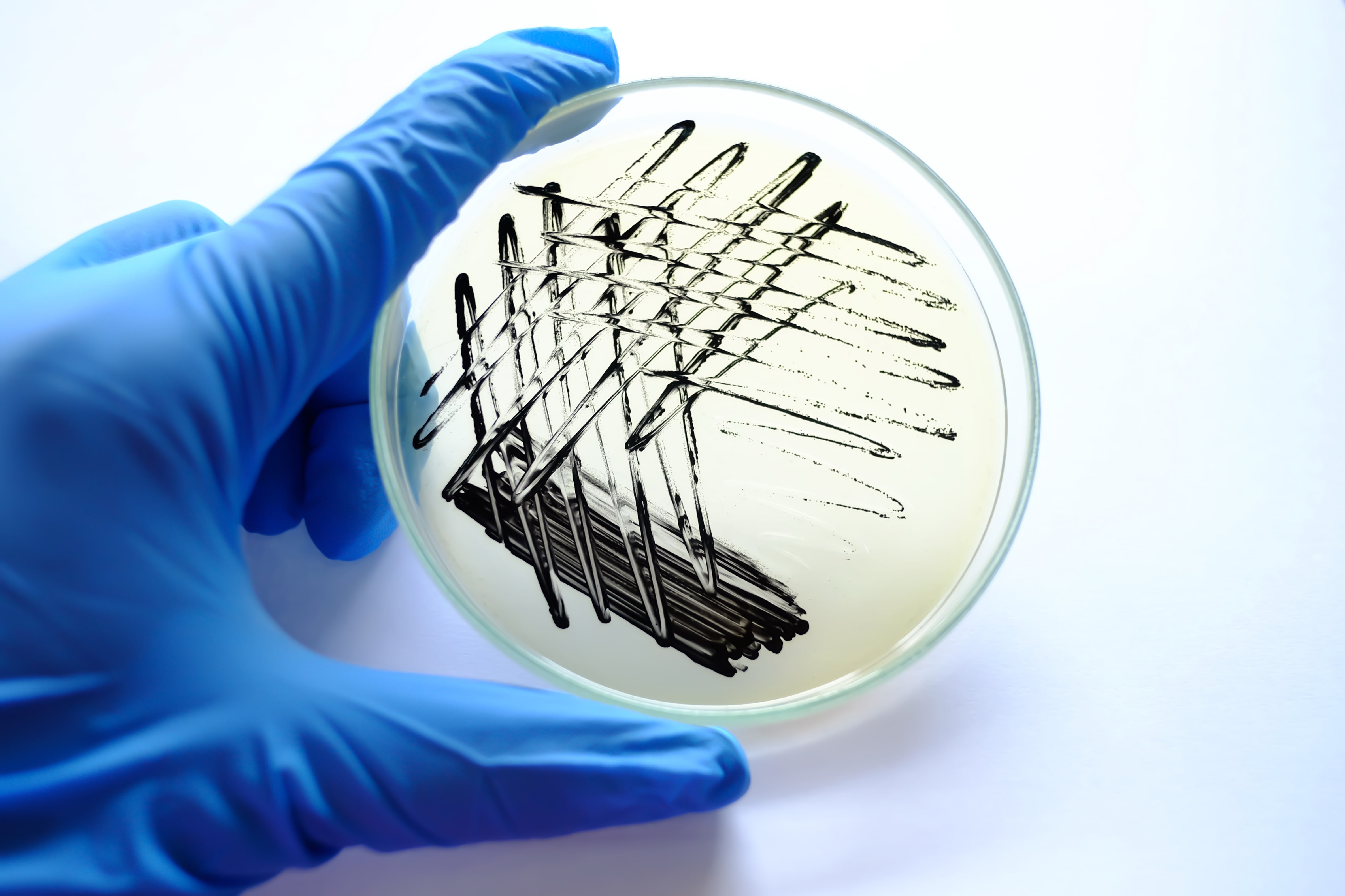 Plant Pathology Web - Type of Microbial Culture Media Although all