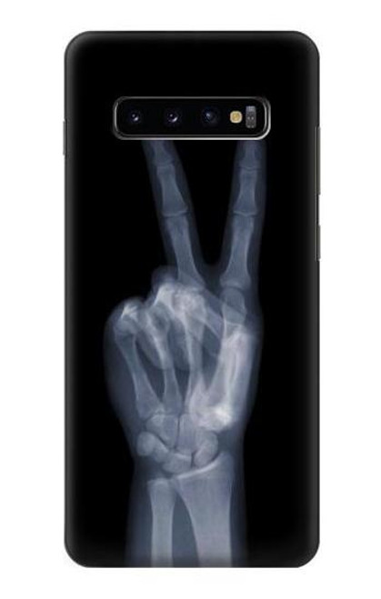 W3101 X-ray Peace Sign Fingers Funda Carcasa Case y Caso Del Tirón Funda para Samsung Galaxy S10 Plus
