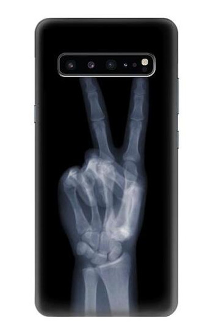 W3101 X-ray Peace Sign Fingers Funda Carcasa Case y Caso Del Tirón Funda para Samsung Galaxy S10 5G