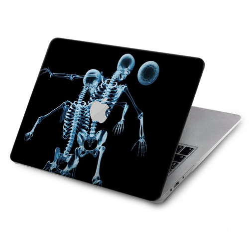 W1111 Soccer X-ray Funda Carcasa Case para MacBook Air 13″ - A1932, A2179, A2337