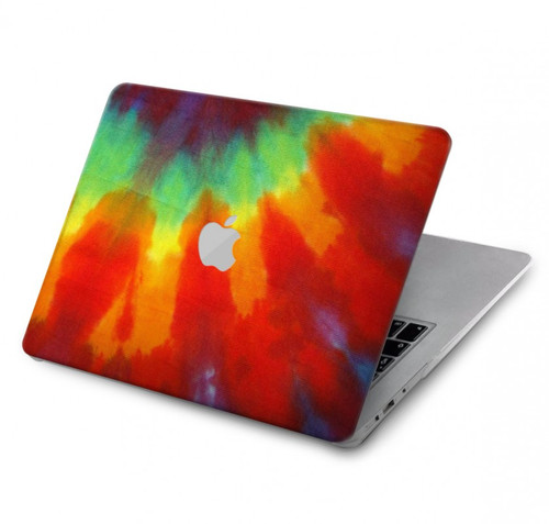 W2985 Colorful Tie Dye Texture Funda Carcasa Case para MacBook Pro 14 M1,M2,M3 (2021,2023) - A2442, A2779, A2992, A2918