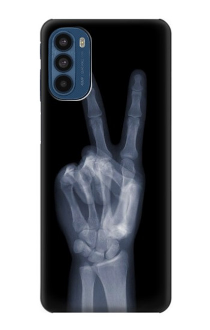 W3101 X-ray Peace Sign Fingers Funda Carcasa Case y Caso Del Tirón Funda para Motorola Moto G41