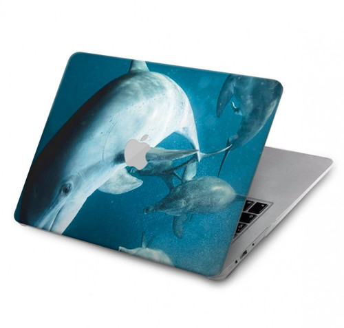 W3878 Dolphin Funda Carcasa Case para MacBook Air 13″ - A1369, A1466