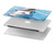 W1291 Dolphin Funda Carcasa Case para MacBook Air 15″ (2023,2024) - A2941, A3114