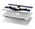 W2758 Anchor Navy Funda Carcasa Case para MacBook Air 15″ (2023,2024) - A2941, A3114