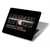 W3242 Analog Radio Tuning Funda Carcasa Case para MacBook 12″ - A1534