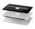 W3242 Analog Radio Tuning Funda Carcasa Case para MacBook 12″ - A1534