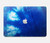 W1869 Tie Dye Blue Funda Carcasa Case para MacBook Air 13″ - A1369, A1466