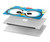 W2521 Cute Nerd Owl Cartoon Funda Carcasa Case para MacBook Air 13″ - A1369, A1466