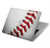 W1842 New Baseball Funda Carcasa Case para MacBook Air 13″ - A1932, A2179, A2337