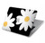 W2315 Daisy White Flowers Funda Carcasa Case para MacBook Air 13″ - A1932, A2179, A2337