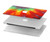 W2985 Colorful Tie Dye Texture Funda Carcasa Case para MacBook Pro 15″ - A1707, A1990