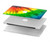 W3422 Tie Dye Funda Carcasa Case para MacBook Pro 15″ - A1707, A1990