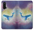 W3802 Dream Whale Pastel Fantasy Funda Carcasa Case y Caso Del Tirón Funda para OnePlus Nord CE 5G