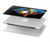 W3842 Abstract Colorful Diamond Funda Carcasa Case para MacBook Pro 13″ - A1706, A1708, A1989, A2159, A2289, A2251, A2338