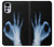 W3239 X-Ray Hand Sign OK Funda Carcasa Case y Caso Del Tirón Funda para Motorola Moto G22