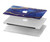 W3906 Navy Blue Purple Marble Funda Carcasa Case para MacBook Pro 14 M1,M2,M3 (2021,2023) - A2442, A2779, A2992, A2918