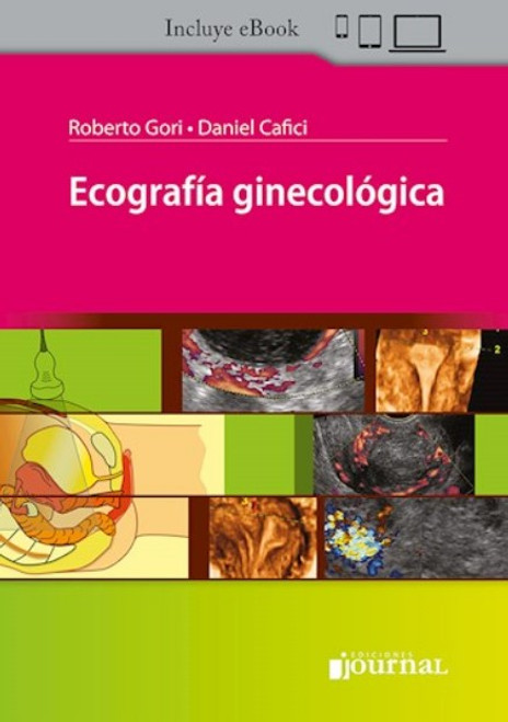 Ecografía Ginecológica - Gori, Cafici