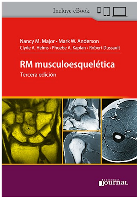 RM musculoesquelética - Major,, Nancy M. Anderson, Mark W. Helms, Clyde A. Kaplan, Phoebe A. Dussault, Robert