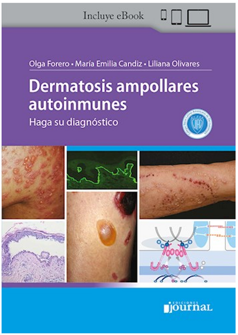 Dermatosis ampollares autoinmunes: Haga su diagnóstico - Candiz, María Emilia Forero, Olga Olivares, Liliana