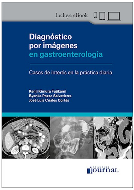 Diagnóstico por imágenes en gastroenterología Casos de interés en la práctica diaria