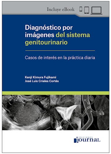 Diagnóstico por imágenes del sistema genitourinario Casos de interés en la práctica diaria