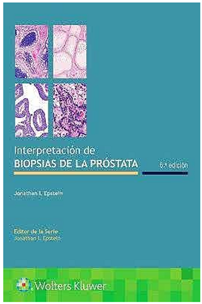 Interpretación de Biopsias de la Próstata - Epstein, Jonathan I.