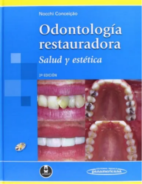 Odontologia Restauradora. Salud Y Estetica Nocchi