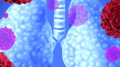 Depiction of the lungs with molecules surrounding them