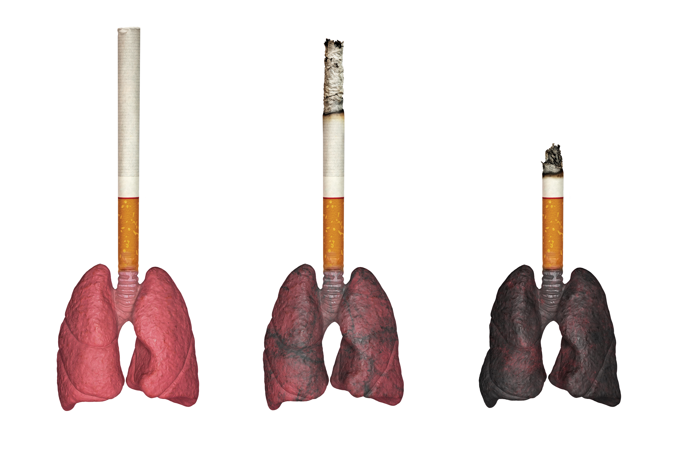 Cigarettes Before And After Lungs