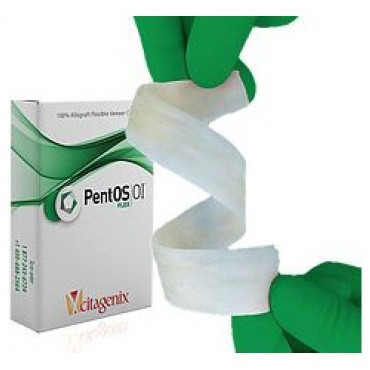 PentOS OI 15mm x 15mm Flex Cortical Veneer Graft