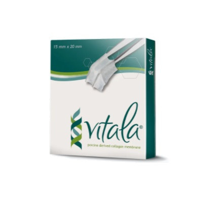 Osteogenics 20mm x 30mm Vitala® Porcine Pericardium Collagen Membrane (VIT2030)