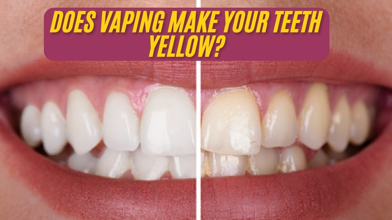 do juul pods stain teeth Does Vaping Make Your Yellow? What Top Dentists Say Resistance:0.8 ohm geek bar pulse best aries